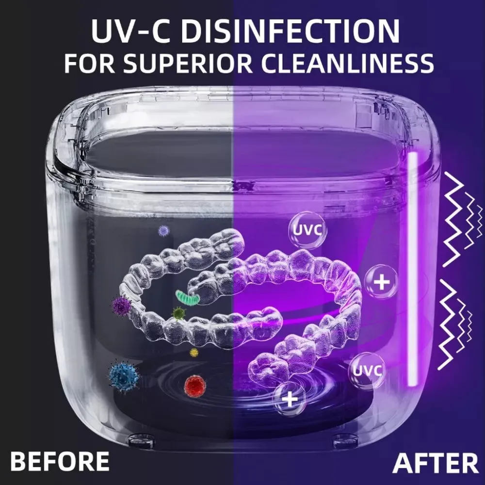 Ultrasonic Retainer Cleaner – 45kHz Deep Cleaning with UV & 3 Modes